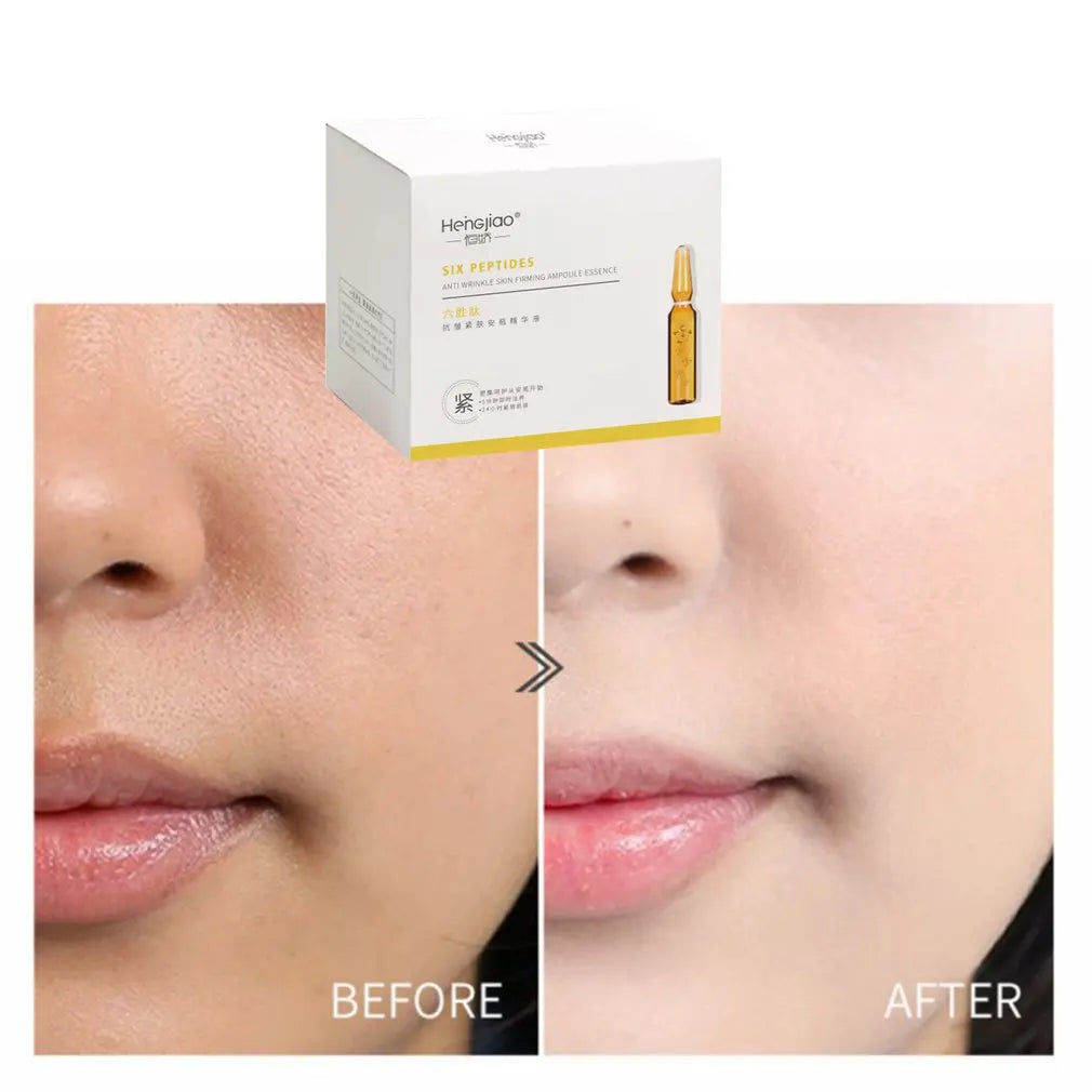 28 Bottle/Set Fullerene Hyaluronic Acid Ampoule Face Serum Shrink Pores Anti-Ance Nicotinamide Whitening Moisturizing Wrinkle