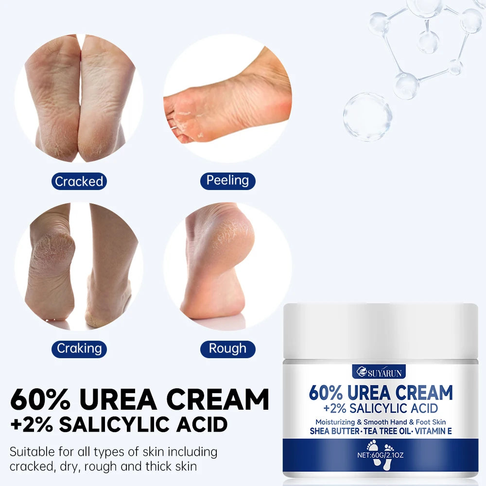 SUYARUN Fußcreme mit 60 % Urea
