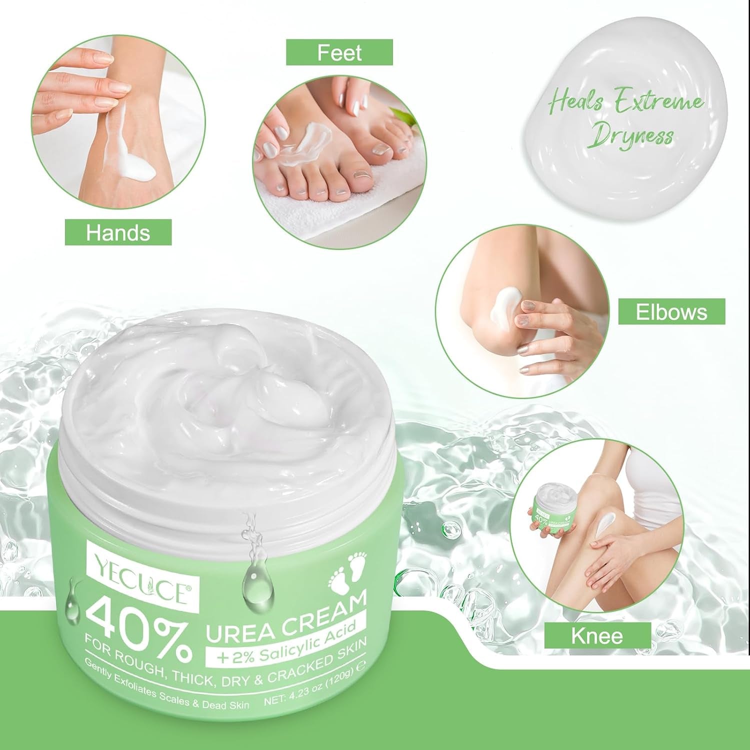 Urea-Fußcreme, Urea-Creme 40 Prozent Für Die Füße, Mit Hyaluronsäure, Teebaum Und Aloe Vera, Fersenbalsam Zur Hornhautentfernung Und Erweichung, Für Trockene, Rissige Füße, Fersen Und Hände (120 G)
