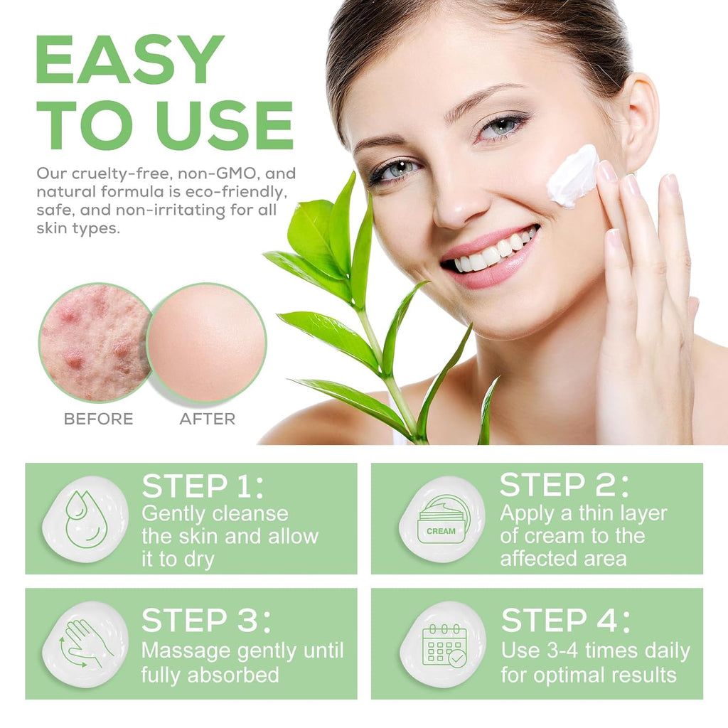 Urea-Fußcreme, Urea-Creme 40 Prozent Für Die Füße, Mit Hyaluronsäure, Teebaum Und Aloe Vera, Fersenbalsam Zur Hornhautentfernung Und Erweichung, Für Trockene, Rissige Füße, Fersen Und Hände (120 G)