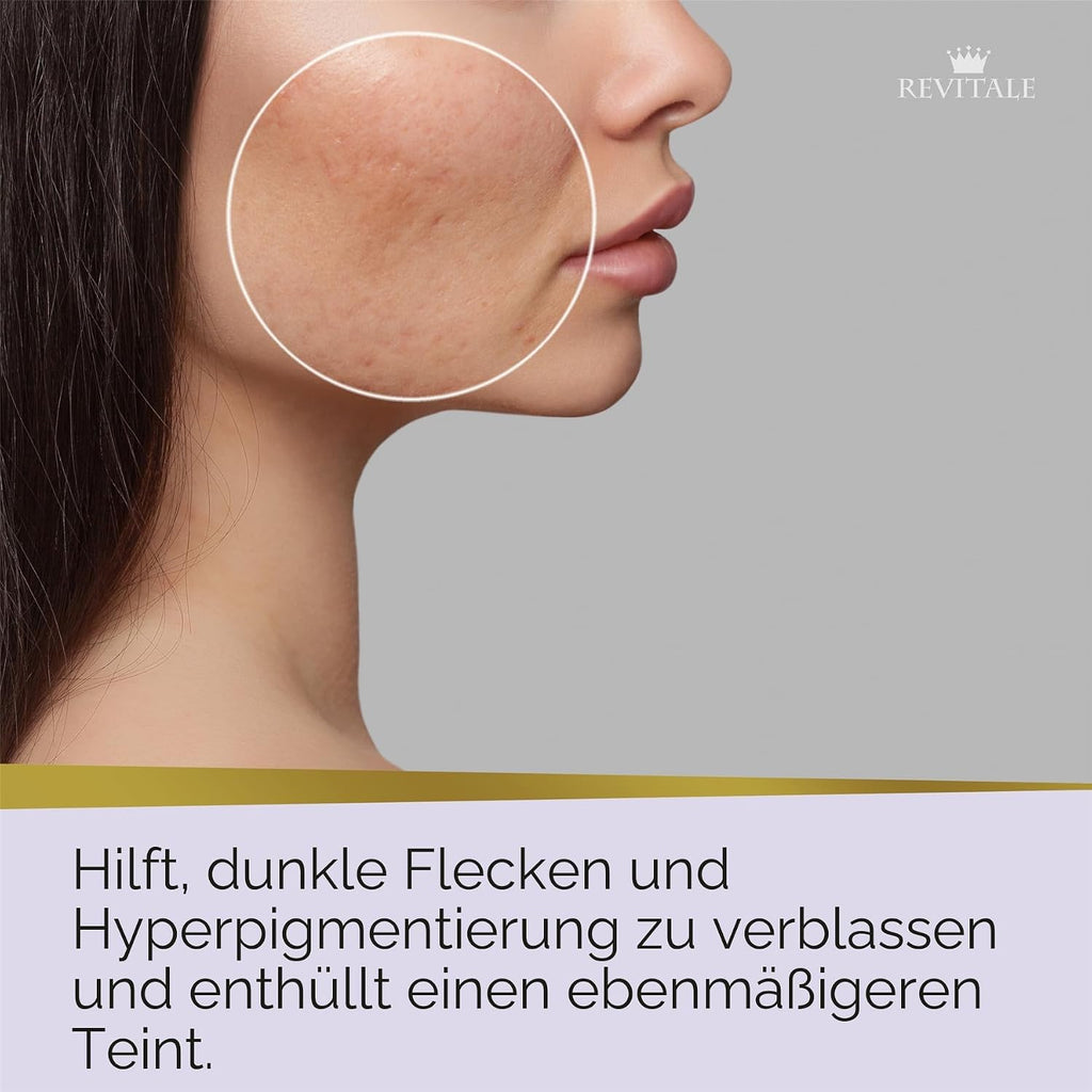 Revitale Advanced Azelainsäure- & Niacinamid-Seife – Beruhigende Reinigungsseife Für Glatte, Ausgeglichene & Geschützte Haut