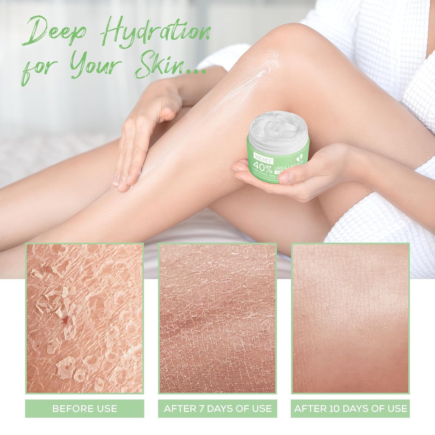 Urea-Fußcreme, Urea-Creme 40 Prozent Für Die Füße, Mit Hyaluronsäure, Teebaum Und Aloe Vera, Fersenbalsam Zur Hornhautentfernung Und Erweichung, Für Trockene, Rissige Füße, Fersen Und Hände (120 G)