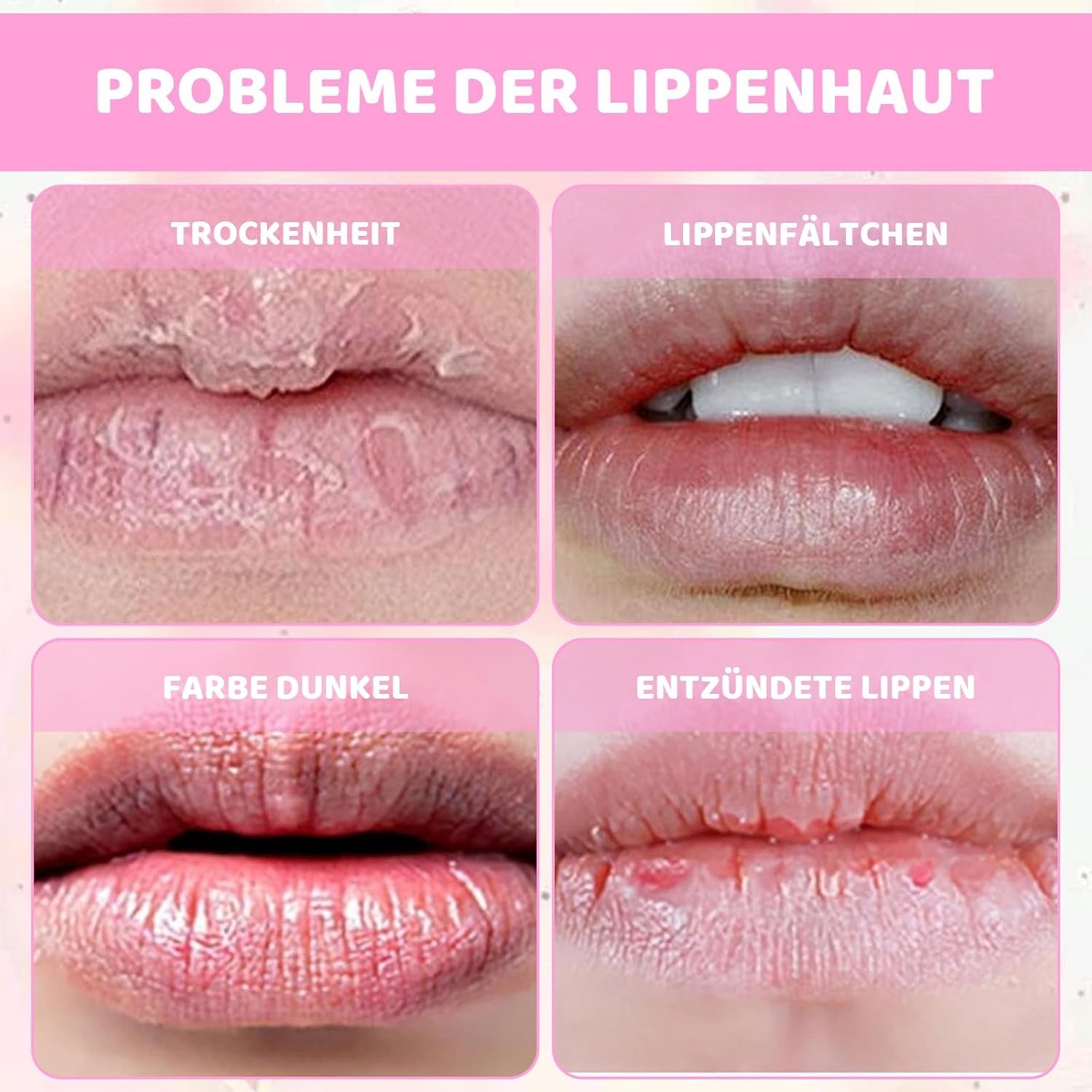 16 Stück Sommer Lippenpflege Set – Feuchtigkeitsspendende Lippenmaske und Lipgloss für strahlende Lippen, ideal für Mädchen und tägliche Pflege